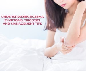 Understanding Eczema: Symptoms, Triggers, and Management Tips
