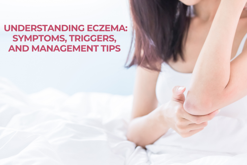 Understanding Eczema Symptoms, Triggers, and Management Tips