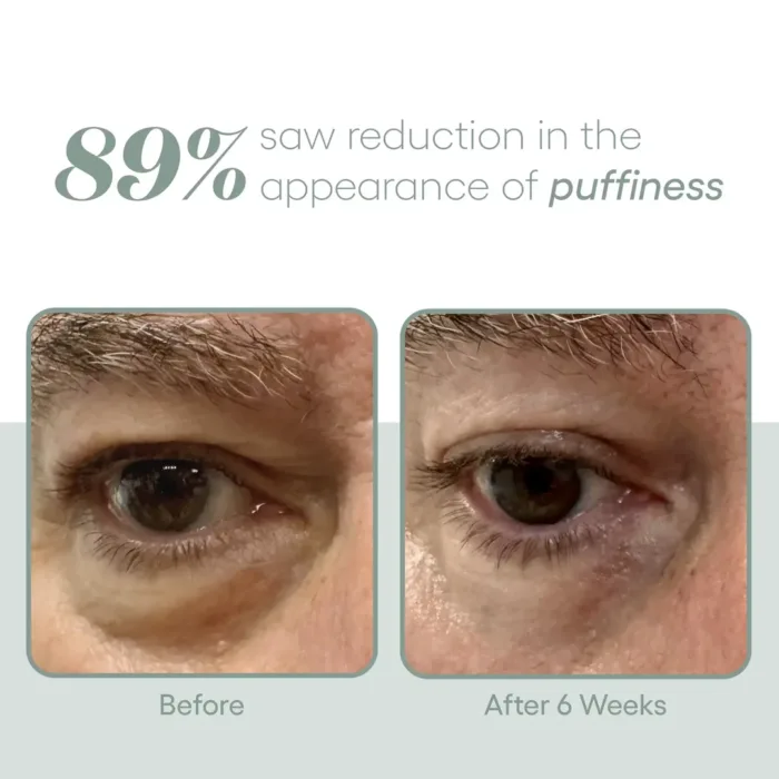 (plated) Skin Science EYE Serum - Image 2